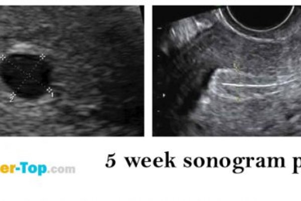 Кракен дарк сайт